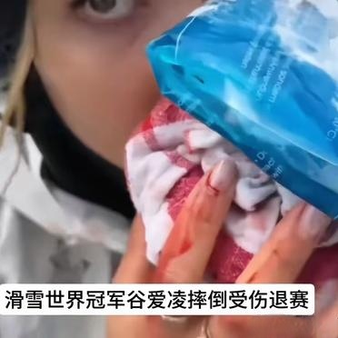 意外发生：一名选手在比赛中摔倒